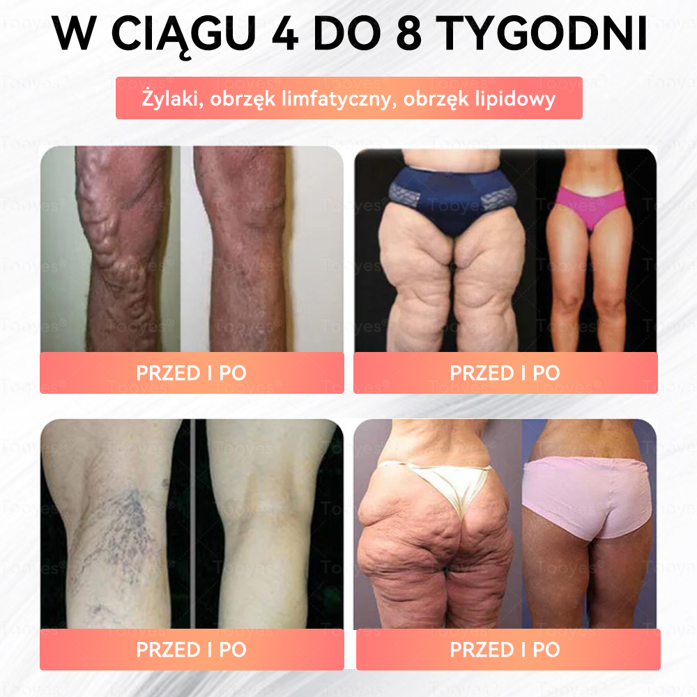 🎁 Zostało tylko 5 pudełek. Oferujemy dodatkową zniżkę 50%! Utrzymaj zdrową sylwetkę. Jeśli teraz przegapisz tę okazję, w przyszłym roku już jej nie będzie.