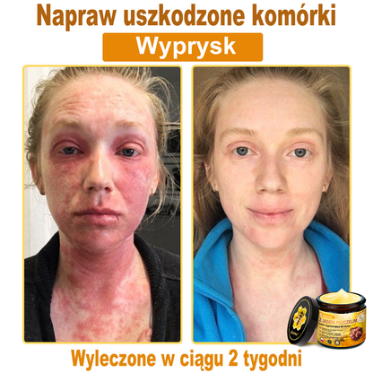 Leurea® Krem z Jadem Pszczelim 🔥 Regeneracja skóry, redukcja zmarszczek i promienny wygląd – 50 ml