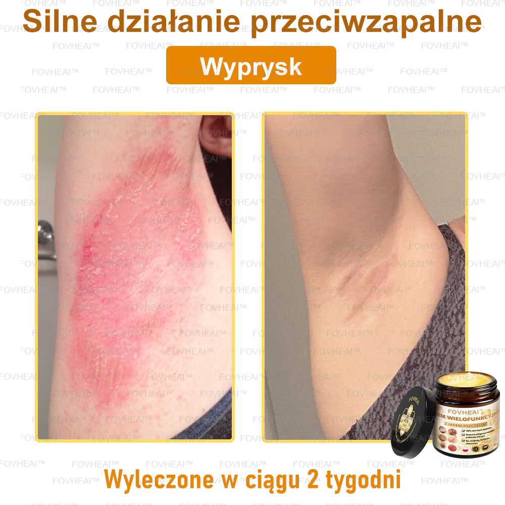 ✨FOVHEAl™ Krem z Jadem Pszczelim – Wygładza zmarszczki i przywraca młody wygląd – 50 ml