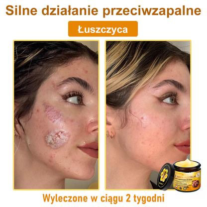 Leurea® Krem z Jadem Pszczelim 🔥 Regeneracja skóry, redukcja zmarszczek i promienny wygląd – 50 ml