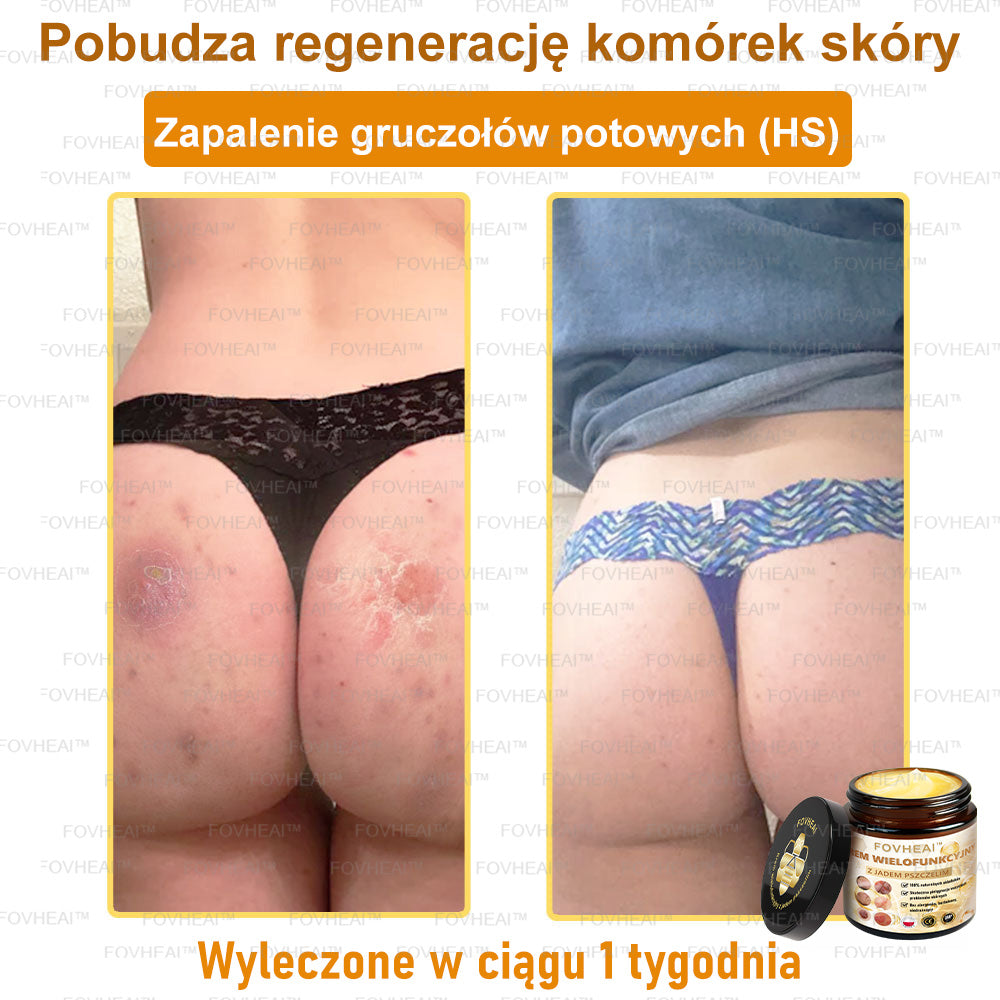 ✨FOVHEAl™ Krem z Jadem Pszczelim – Wygładza zmarszczki i przywraca młody wygląd – 50 ml