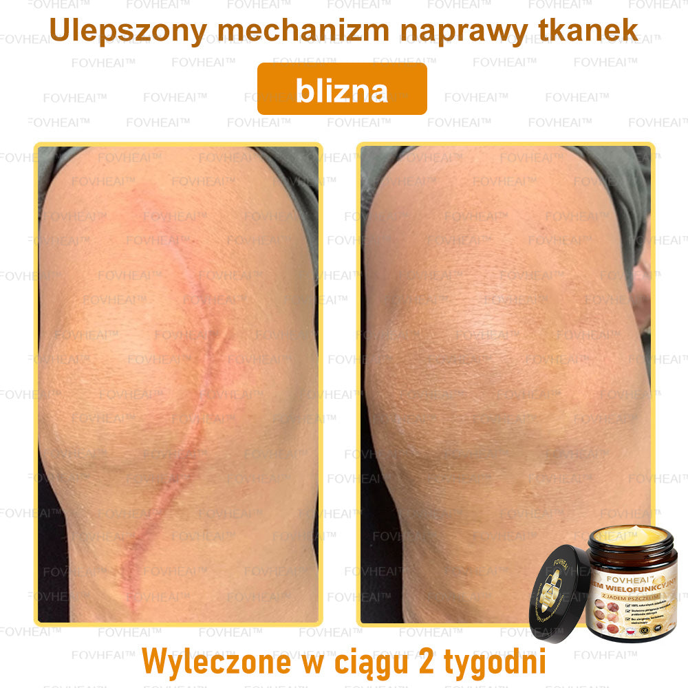 ✨FOVHEAl™ Krem z Jadem Pszczelim – Wygładza zmarszczki i przywraca młody wygląd – 50 ml